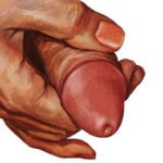 Гнойные выделения из уретры у мужчин: причины, чем это опасно и как лечить
