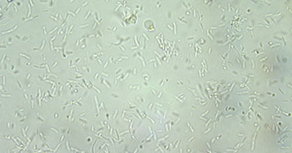 Бактерии в моче