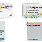 Антибиотики при цистите у женщин: применение и описание эффективных средств