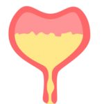 Может ли у человека лопнуть мочевой пузырь: симптомы и лечение разрыва